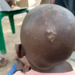 Kinder haben Parasiten – PMCO Uganda e.V.