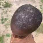 Kinder haben Parasiten – PMCO Uganda e.V.