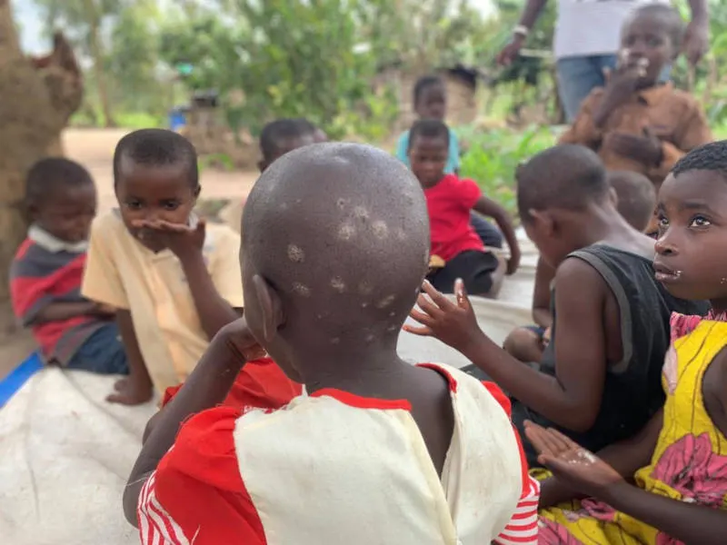 Kinder haben Parasiten – PMCO Uganda e.V.
