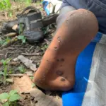 Kinder haben Parasiten – PMCO Uganda e.V.